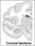 Coronal Sections